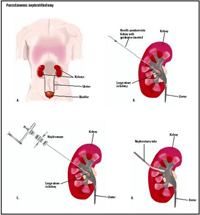 UROSURGICAL AND MEDICAL DEPARTMENT